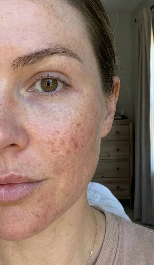 Day 1