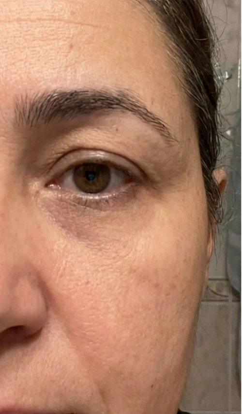 Day 60