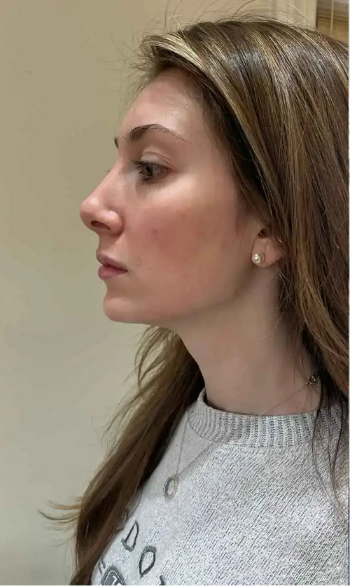 Day 30